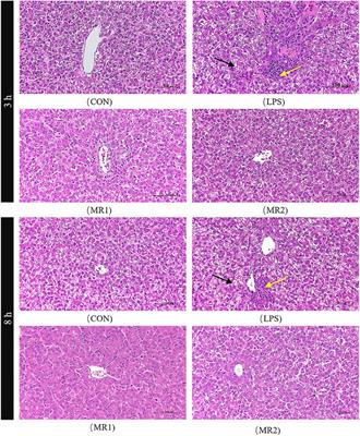 Dietary methionine restriction alleviates oxidative stress and inflammatory responses in lipopolysaccharide-challenged broilers at early age